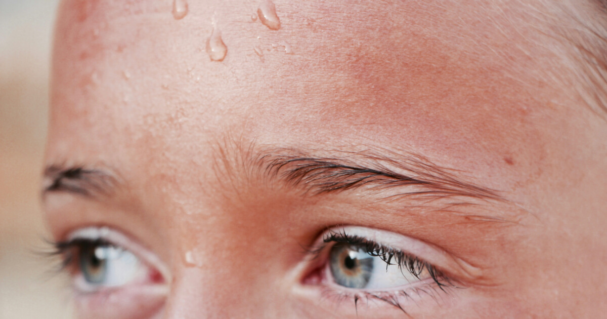 Egy ember szeme és izzadó homloka közelről.